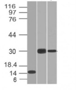 Elastase Antibody (CELA3B/1218), Novus Biologicals 0.2mg; Unlabeled:Antibodies,