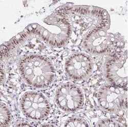 Elf4/MEF Antibody, Novus Biologicals:Antibodies:Primary Antibodies