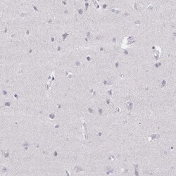 Elf4/MEF Antibody, Novus Biologicals:Antibodies:Primary Antibodies