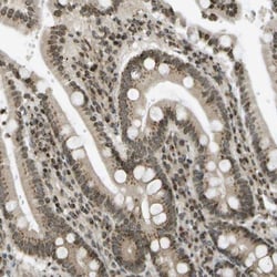 Ellis van Creveld syndrome Antibody, Novus Biologicals 25 &mu;L; Unlabeled:Antibodies,