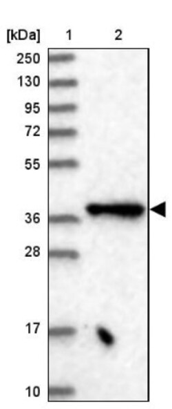 Elp4 Antibody, Novus Biologicals 0.1mL; Unlabeled:Antibodies, Polyclonal