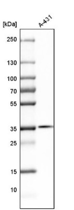 Emerin Antibody, Novus Biologicals 0.1mL; Unlabeled:Antibodies, Polyclonal