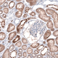 NDUFB5 Antibody, Novus Biologicals:Antibodies:Primary Antibodies
