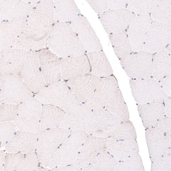 NDUFB5 Antibody, Novus Biologicals:Antibodies:Primary Antibodies