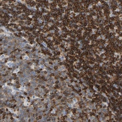 Enah/Vasp-like Antibody, Novus Biologicals 0.1mL; Unlabeled:Antibodies,