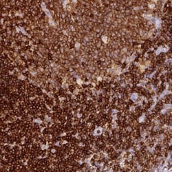 Enah/Vasp-like Antibody, Novus Biologicals 0.1mL; Unlabeled:Antibodies,