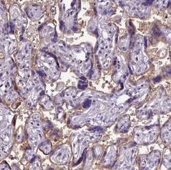 Endoglin/CD105 Antibody, Novus Biologicals 25 &mu;L | Buy Online | Novus Biologicals | Fisher Scientific