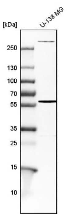 Endoglin/CD105 Antibody, Novus Biologicals 25 &mu;L | Buy Online | Novus Biologicals | Fisher Scientific