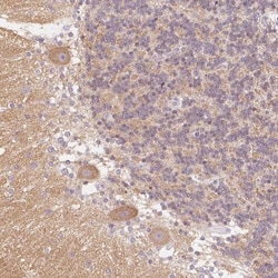 Endophilin A1/SH3GL2 Antibody, Novus Biologicals:Antibodies:Primary Antibodies