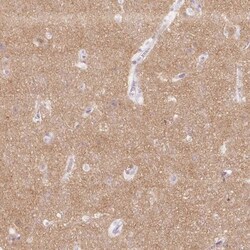 Endophilin A1/SH3GL2 Antibody, Novus Biologicals:Antibodies:Primary Antibodies
