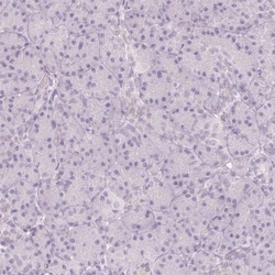 Endophilin A1/SH3GL2 Antibody, Novus Biologicals:Antibodies:Primary Antibodies