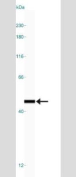 Endophilin B1/Bif-1 Antibody (30A882.1.1) - Azide Free, Novus Biologicals 0.1 mg | Buy Online | Novus Biologicals | Fisher Scientific