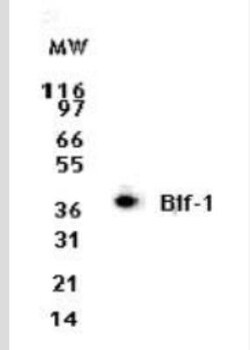 Endophilin B1/Bif-1 Antibody (30A882.1.1) - Azide Free, Novus Biologicals 0.1 mg | Buy Online | Novus Biologicals | Fisher Scientific