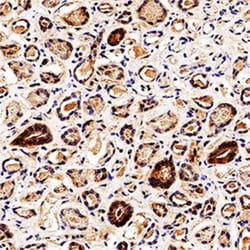 Endophilin B1/Bif-1 Antibody (30A882.1.1) - BSA Free, Novus Biologicals:Antibodies:Primary