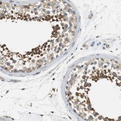 Endophilin B1/Bif-1 Antibody, Novus Biologicals 0.1mL; Unlabeled:Antibodies,
