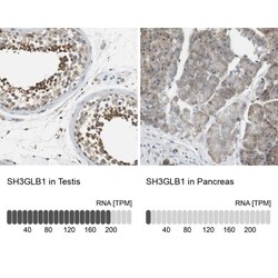 Endophilin B1/Bif-1 Antibody, Novus Biologicals 0.1mL; Unlabeled:Antibodies,