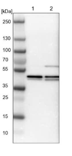Endophilin B1/Bif-1 Antibody, Novus Biologicals 0.1mL; Unlabeled:Antibodies,
