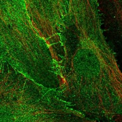 Endosialin/CD248/TEM1 Antibody, Novus Biologicals:Antibodies:Primary Antibodies