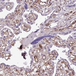Endosialin/CD248/TEM1 Antibody, Novus Biologicals:Antibodies:Primary Antibodies
