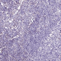 Endosialin/CD248/TEM1 Antibody, Novus Biologicals:Antibodies:Primary Antibodies
