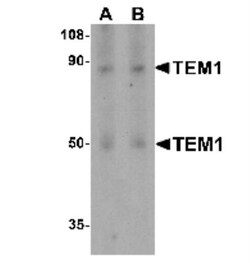 Endosialin/CD248/TEM1 Antibody - BSA Free, Novus Biologicals 0.1mg; Unlabeled:Antibodies,