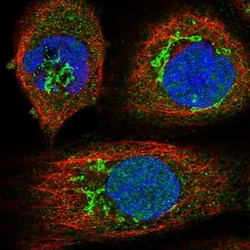 Endothelin-1 Antibody, Novus Biologicals:Antibodies:Primary Antibodies