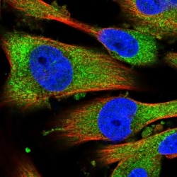 Endothelin 2 Antibody, Novus Biologicals 25 &mu;L; Unlabeled:Antibodies,