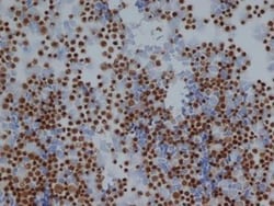 Enolase 1 Antibody, Novus Biologicals 0.5mL; Unlabeled:Antibodies, Polyclonal