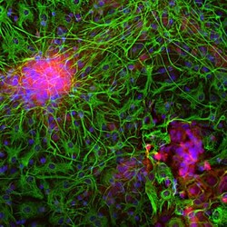 Enolase 2/Neuron-specific Enolase Antibody, Novus Biologicals 0.1mL; Unlabeled:Antibodies,