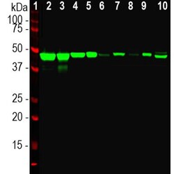 Enolase 2/Neuron-specific Enolase Antibody, Novus Biologicals 0.1mL; Unlabeled:Antibodies,