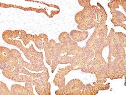 EpCAM/TROP1 Mouse, Clone: 323/A3, Novus Biologicals 0.2mg; Unlabeled:Antibodies,