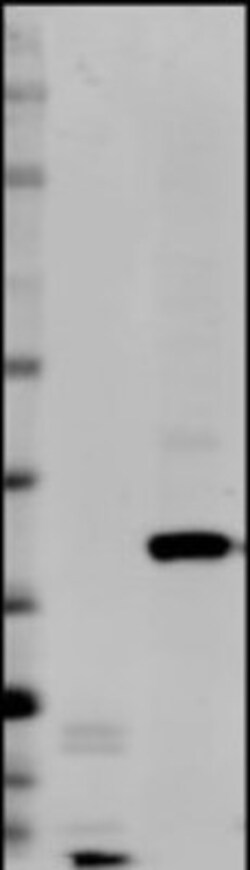 EpCAM/TROP1 Antibody (AUA1) - BSA Free, Novus Biologicals 0.1mL; Unlabeled:Antibodies,