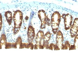 EpCAM/TROP1 Antibody (EGP40/1110) - (ECD) - Azide and BSA Free, Novus Biologicals
