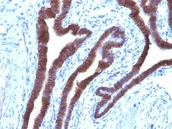 EpCAM/TROP1 Antibody (EGP40/1110) - (ECD) - Azide and BSA Free, Novus Biologicals