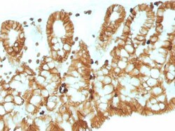 EpCAM/TROP1 Antibody (EGP40/1110) - (ECD) - Azide and BSA Free, Novus Biologicals