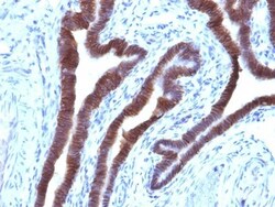 EpCAM/TROP1 Antibody (EGP40/1110) - (ECD), Novus Biologicals 0.2mg; Unlabeled:Antibodies,