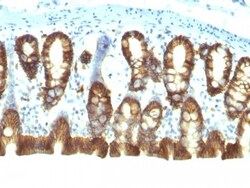 EpCAM/TROP1 Antibody (EGP40/1110) - (ECD), Novus Biologicals 0.2mg; Unlabeled:Antibodies,