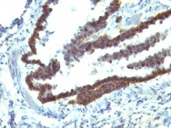 EpCAM/TROP1 Antibody (EGP40/1110) - (ECD), Novus Biologicals 0.2mg; Unlabeled:Antibodies,