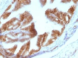 EpCAM/TROP1 Antibody (EGP40/1110) - (ECD), Novus Biologicals 0.2mg; Unlabeled:Antibodies,