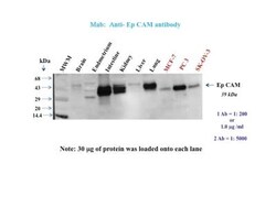 EpCAM/TROP1 Antibody (EGP40/1110) - (ECD), Novus Biologicals 0.2mg; Unlabeled:Antibodies,