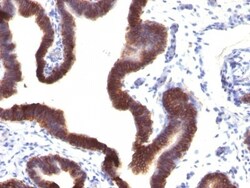 EpCAM/TROP1 Antibody (EGP40/1120) - (ECD), Novus Biologicals 0.2mg; Unlabeled:Antibodies,