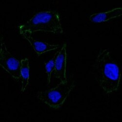 EpCAM/TROP1 Antibody (EGP40/837) - (ECD), Novus Biologicals 0.2mg; Unlabeled:Antibodies,