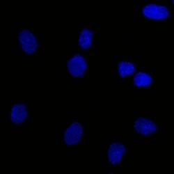 EpCAM/TROP1 Antibody (EGP40/837) - (ECD), Novus Biologicals 0.2mg; Unlabeled:Antibodies,