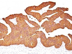 EpCAM/TROP1 Antibody (EGP40/837) - (ECD), Novus Biologicals 0.2mg; Unlabeled:Antibodies,