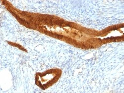 EpCAM/TROP1 Antibody (EGP40/837) - (ECD), Novus Biologicals 0.2mg; Unlabeled:Antibodies,