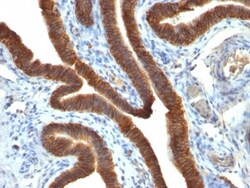 EpCAM/TROP1 Antibody (EGP40/837) - (ECD), Novus Biologicals 0.2mg; Unlabeled:Antibodies,