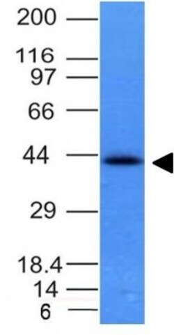 EpCAM/TROP1 Antibody (EGP40/837) - (ECD), Novus Biologicals 0.2mg; Unlabeled:Antibodies,