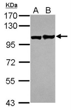 EphA1 Antibody, Novus Biologicals 0.1mL; Unlabeled:Antibodies, Polyclonal