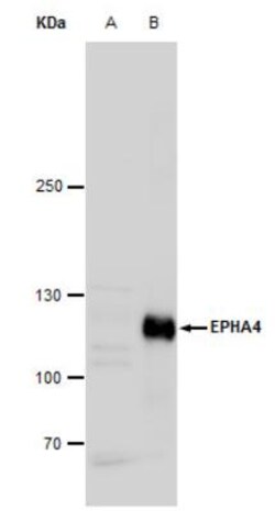 EphA4 Antibody, Novus Biologicals 0.1mL; Unlabeled:Antibodies, Polyclonal