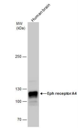 EphA4 Antibody, Novus Biologicals 0.1mL; Unlabeled:Antibodies, Polyclonal